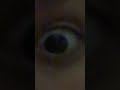:Blinked 199