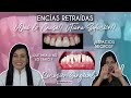 Encías Retraídas, Causas y Soluciones #RecesiónGingival 🦷 - Odontología Láser.