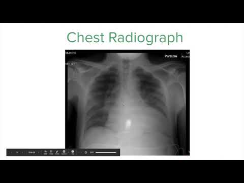 EMCCM   Dr  McCleave   Epigastric Pain   Mesenteric Ischemia