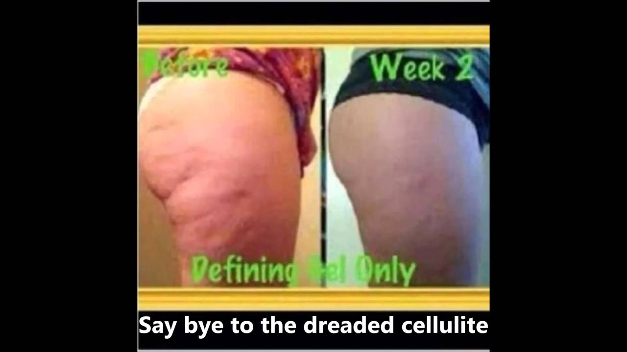 it works defining gel results youtube it works wraps cellulite reviews