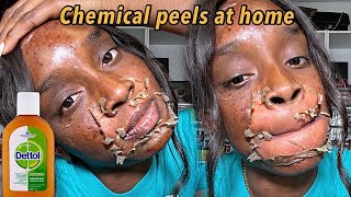 Homemade Chemical Peels That Are Guaranteed to Deliver Results