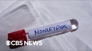 Health officials announce new plan to stretch monkeypox vaccine supply | full video