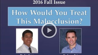 Fall 2016 PCSO Case Report - Drs. Jay Sung, Jason Pair