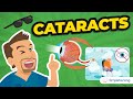 Cataracts Nursing Review: Risks, Red Reflex, Phaco, and Post‑Op Care