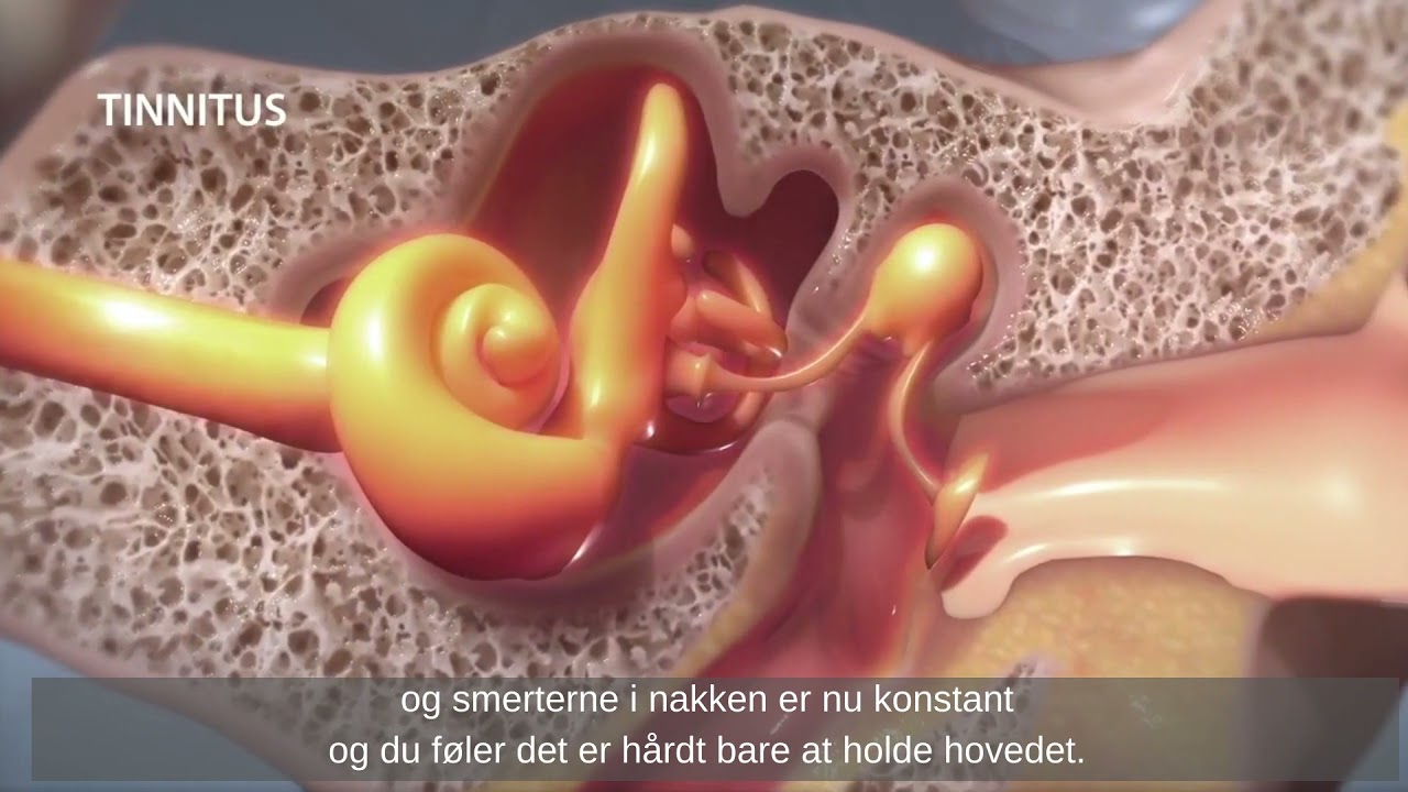 Piskesmæld Fysioterapi behandling i Toldbodgade.