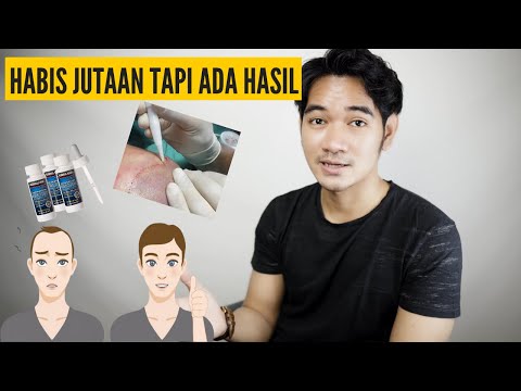 Video: Pembuangan Rambut Laser: Adakah Ia Berfungsi?