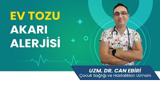 Ev Tozu Akarı Alerjisi