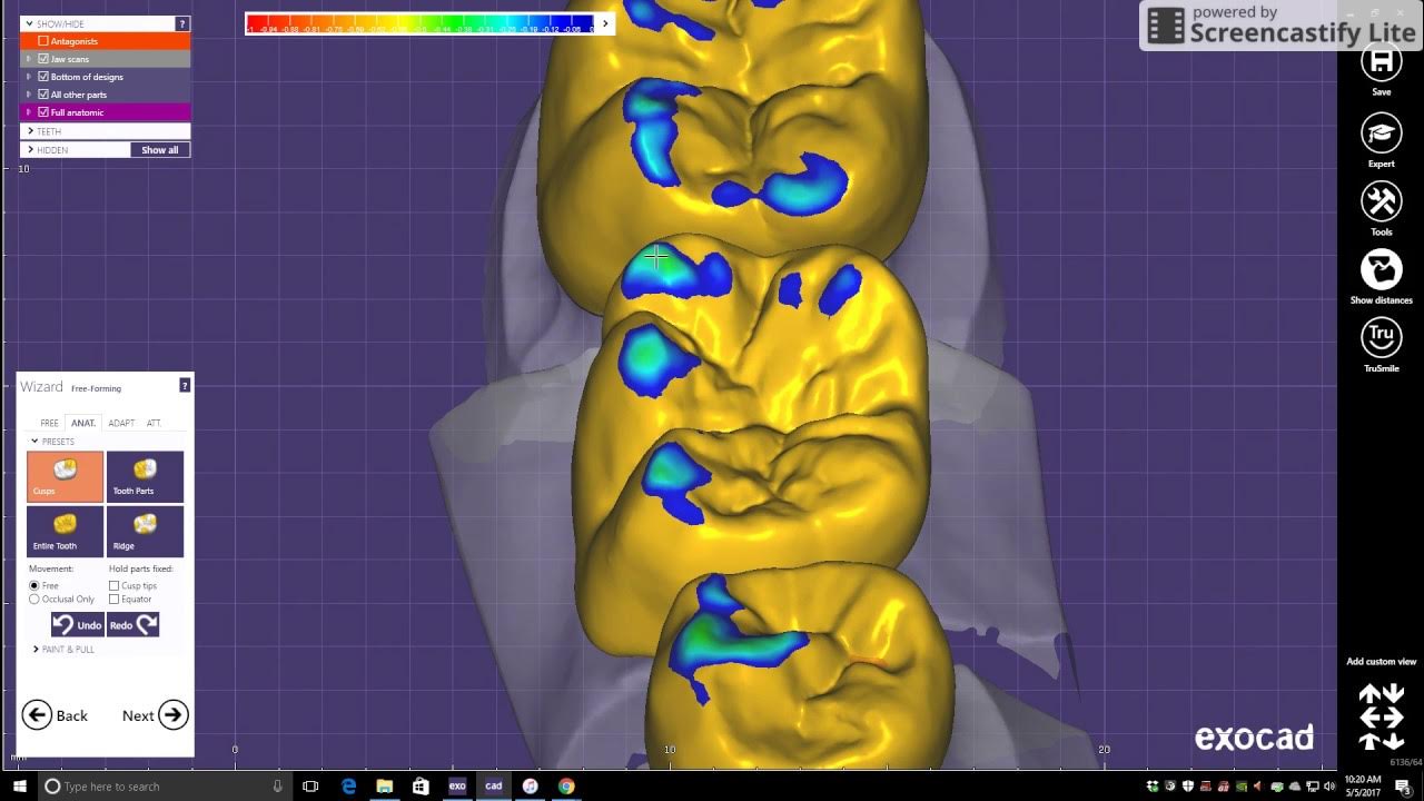 Simple bridge design using Exocad YouTube
