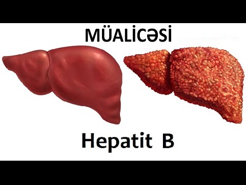 Video: Xroniki Aktiv Hepatit - Tamamilə Veterinar