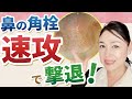 【自宅で除去】鼻の黒ずみを速攻解消！ブラックヘッドいちご鼻の原因と対策を解説！