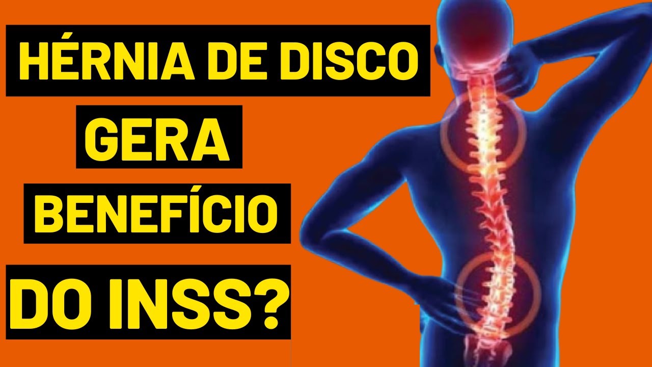 HÉRNIA DE DISCO DÁ DIREITO À APOSENTADORIA POR INVALIDEZ? - YouTube