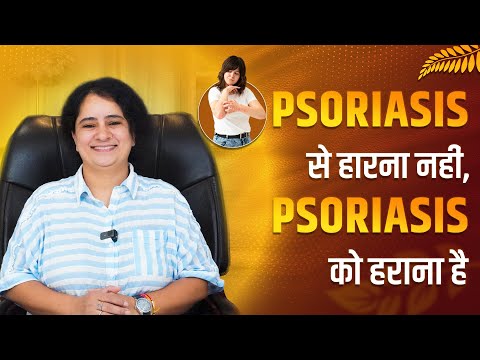 Are you searching for natural ways to manage psoriasis? Ayurveda might be the answer.
