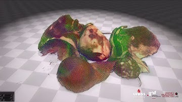 Efficient Surgical Cutting with Position-Based Dynamics