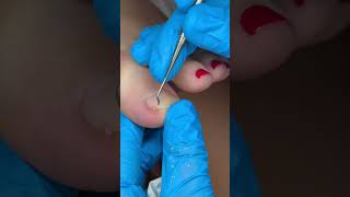Pedicure at Home by Me - Satisfying Process🔊💆‍♀️