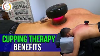 Cupping Therapy Benefits