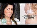 Clube da Plástica: A gordurinha das costas