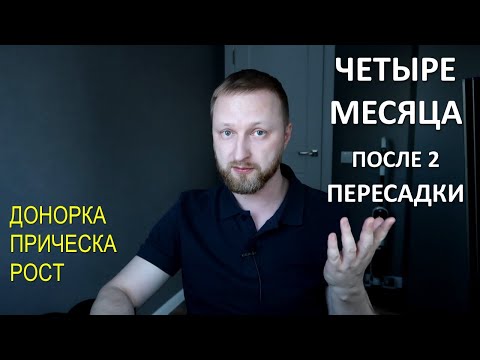 ЧЕТЫРЕ МЕСЯЦА ПОСЛЕ ВТОРОЙ ПЕРЕСАДКИ ВОЛОС