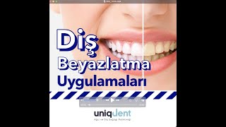 Diş Beyazlatma 5N1K - Uni̇qdent - Uzm Diş Hekimi Alper İlker - Uzm Diş Hekimi Ender İlker