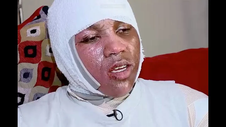 ‘Hot water challenge’ leaves teen seriously injured - Daily News