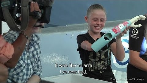 When persons with disabilities lead and participate, the whole world benefits