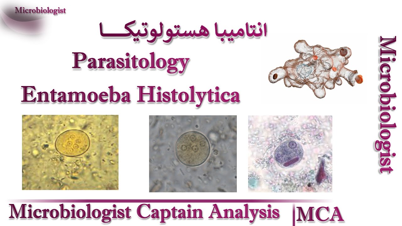 Entamoeba Histolytica الانتاميبا هستوليتيكا طرق الاصابة والاعراض والتشخيص وعلاقتها بامراض الكبد