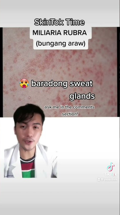 May bungang araw ka ba? Ganito ang gawin mo. Watch till the end! 🌞👌🤔 #skincare #dermatology
