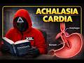 Achalasia Cardia