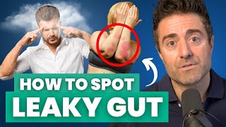 8 Signs Your Gut is LEAKY