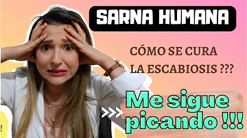 ¿La ducha elimina la sarna?