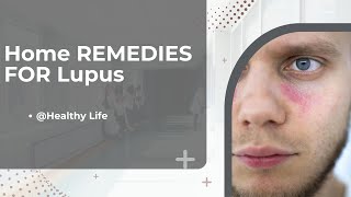 Home Remedies for Lupus #lupus