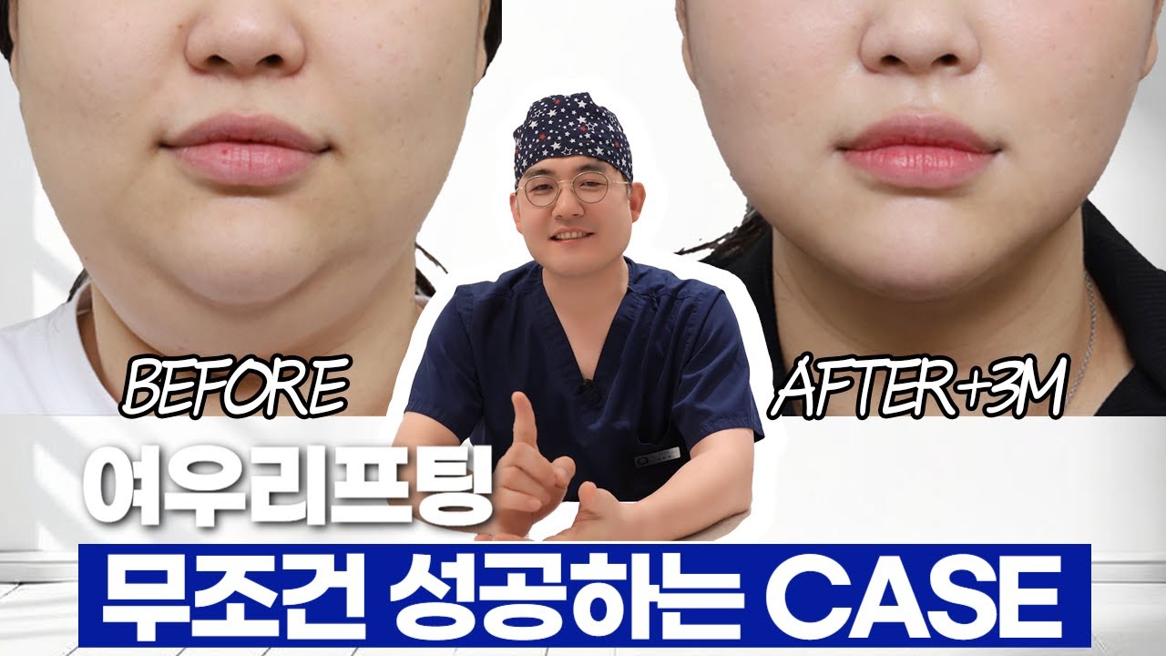 [ЭЙТОП Гоо сайхны клиник] Еоу лифтинг Дахиж бүү эргэлзээрэй🤔ㅣ Энэ ганц бичлэг хангалттай😁 Еоу лифтинг заавал амжилттай болох КЕЙС