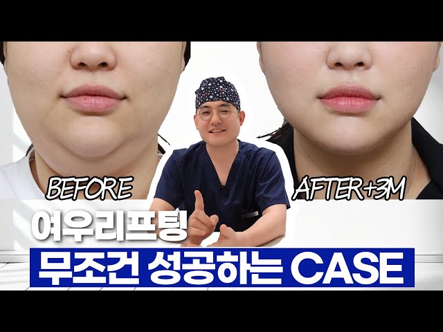 여우리프팅 더 이상 고민하지 마세요🤔ㅣ 이거 영상 하나면 충분합니다😁 여우리프팅 무조건 성공하는 CASE
