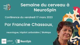 Semaine du cerveau 2023 NeuroSpin CEA | Techniques d'imagerie cérébrale pour traiter l'épilepsie