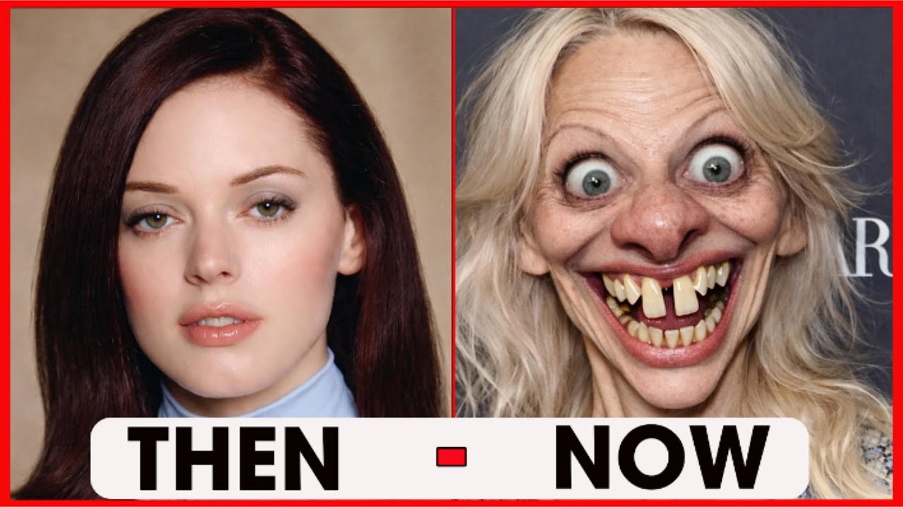 10+ Celebrities Who Ruined Their Faces With Plastic Surgery (Part 2) | Then And Now 2026