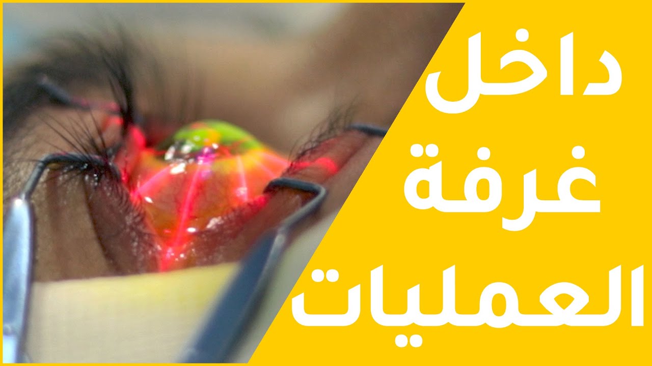 أول واحد كيدخل الكاميرا لغرفة العمليات - القرنية المخروطية