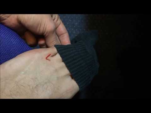 Self accupuncture foot and Morton’s neuroma – Self-acupuncture #4