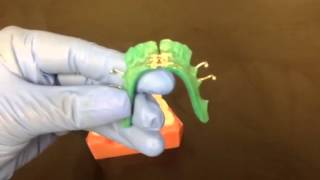 How to make a turn on Removable Expander