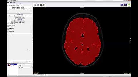 Analyze 14.0 - Measure: Making Volume Measurements