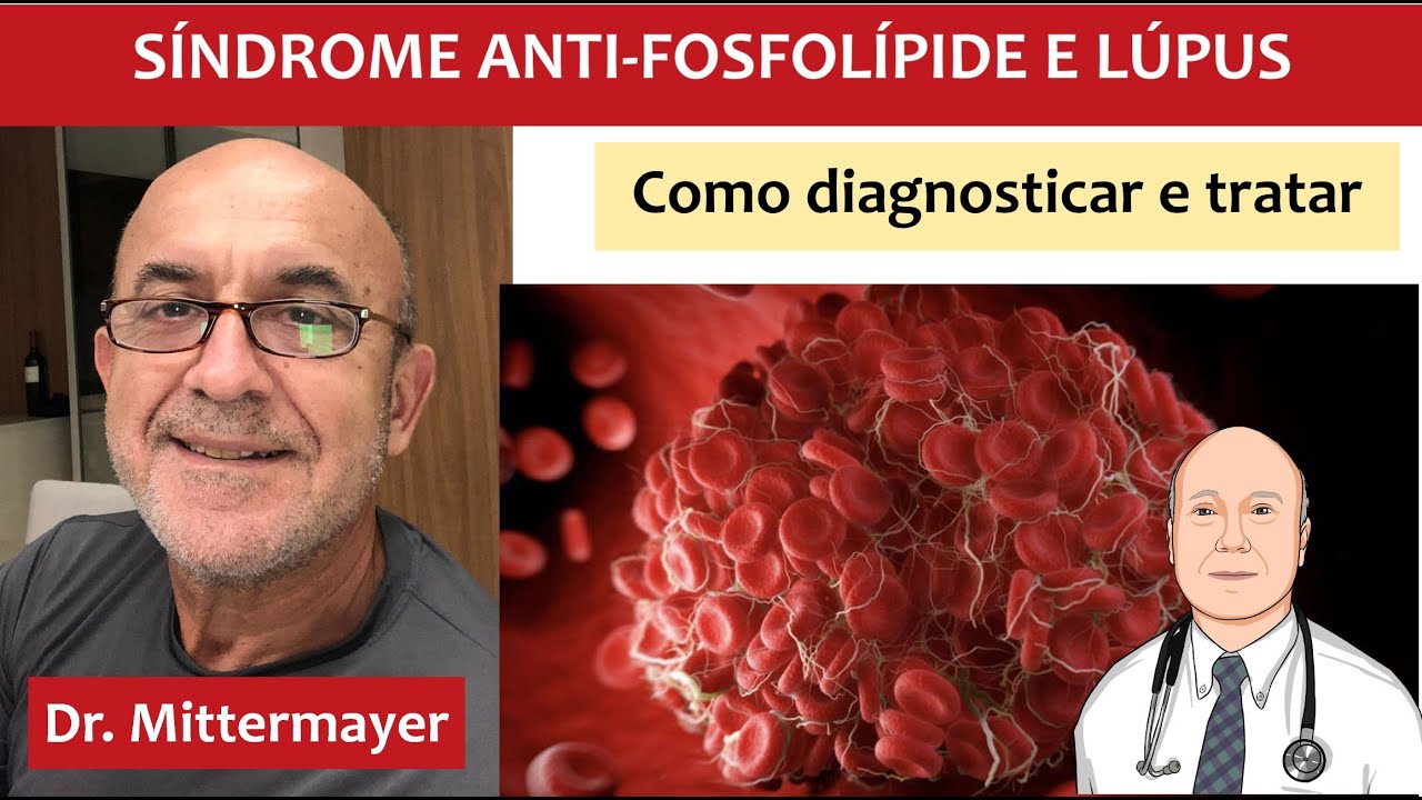 Síndrome anti-fosfolípide e lúpus: sintomas, causas e tratamento correto