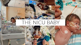 The NICU | our story, c-section scar, $ cost, insane stories, &amp; worst moments