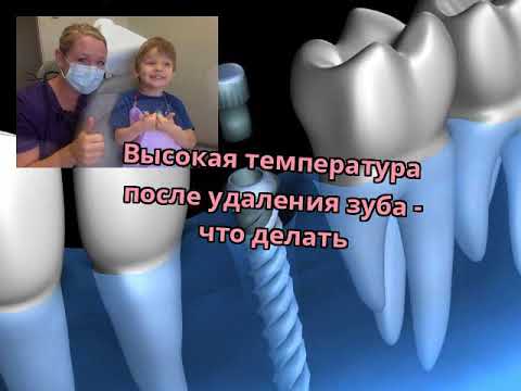Высокая температура после удаления зуба - что делать