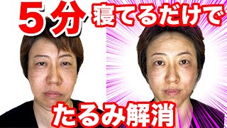 40代50代 たった5分で頬のたるみが解消されて若返る 噂の最新医療美容治療がやばすぎました Youtube