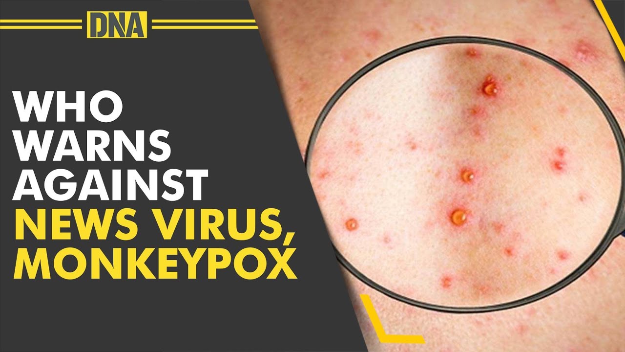 Monkeypox outbreak is primarily spreading through sex, WHO ...