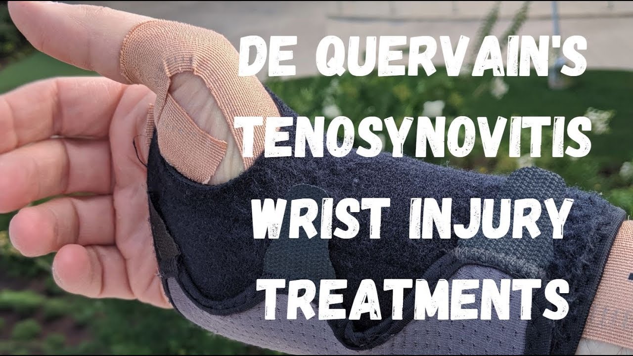 De Quervain's Tenosynovitis Wrist Injury Treatments YouTube
