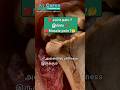 “Joint Pain vs Muscle Pain 😱 Difference தெரியலனா Treatment fail! ⚠️”