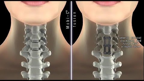 Mobi C vs Fusion Animation Video two level