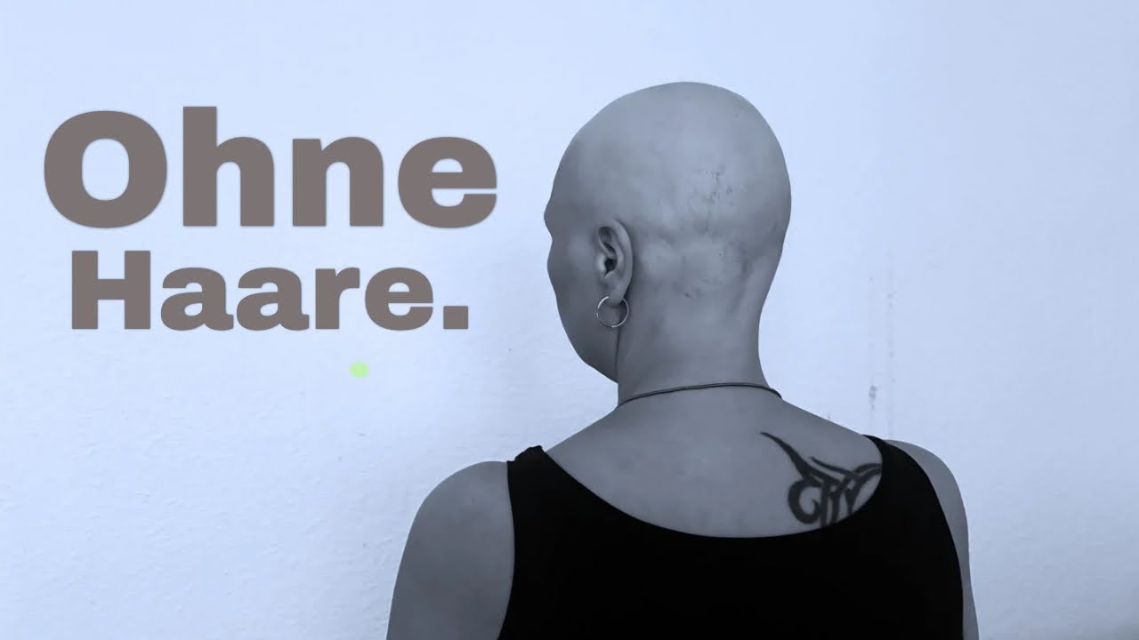 Ich habe Alopecia – das ist meine Geschichte.