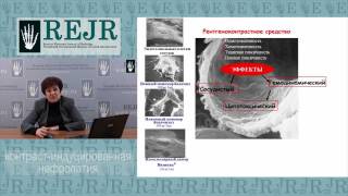 Контраст-индуцированная нефропатия (часть3)