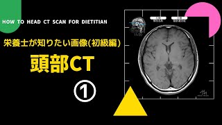 #45の①【栄養士が知りたい画像(初級編)_頭部CT】How to Read  Head CT scan for Dietitian