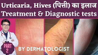 Skin Rash, Urticaria, Hives Treatment | Urticaria, पित्ती उछलने ka ilaj | Dafad On Skin Treatment